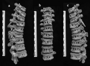 Brucellosis spines